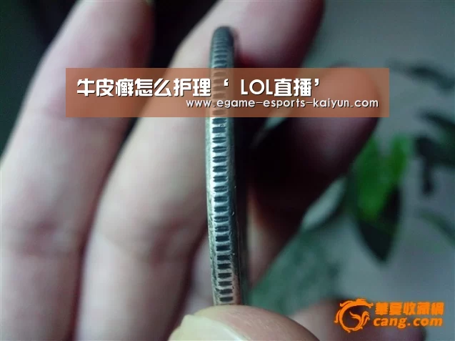牛皮癣怎么护理‘ LOL直播’(图3) 开云电竞